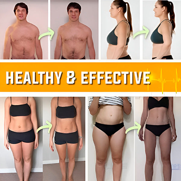 Pojas za Smanjenje Masnih Naslaga i Celulita | SHAPEUP