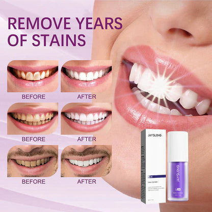 Pasta za Izbeljivanje Zuba