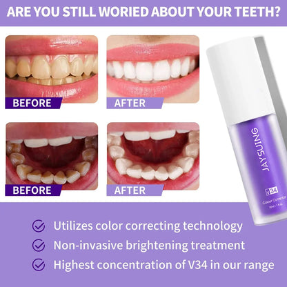 Pasta za Izbeljivanje Zuba