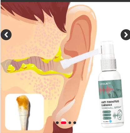 Anti Tinitus Sprej Protiv Zujanja u Ušima
