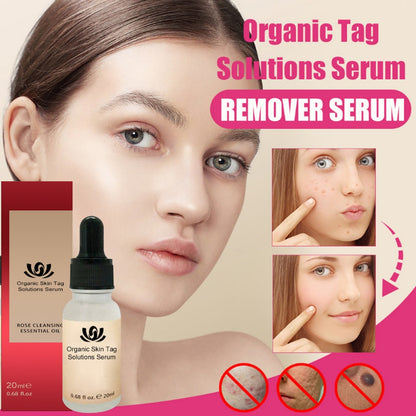 Organski Serum od Ruže za Čišćenje Kože 1+1 GRATIS!